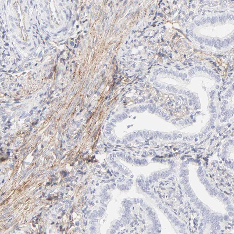 Staining of human endometrium shows weak to moderate membranous positivity in smooth muscle cells.