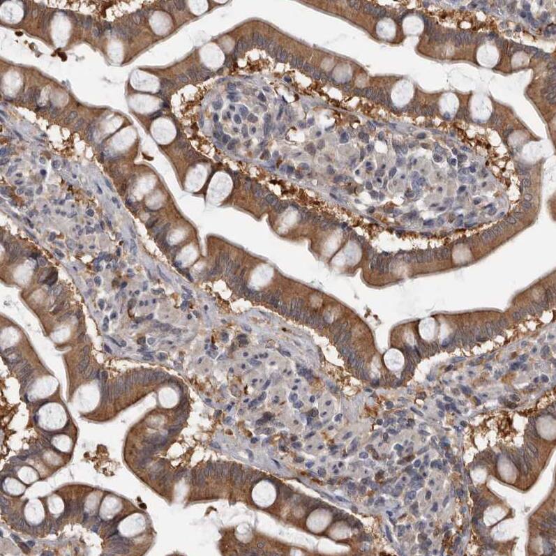 Staining of human small intestine shows moderate to strong cytoplasmic positivity in glandular cells.