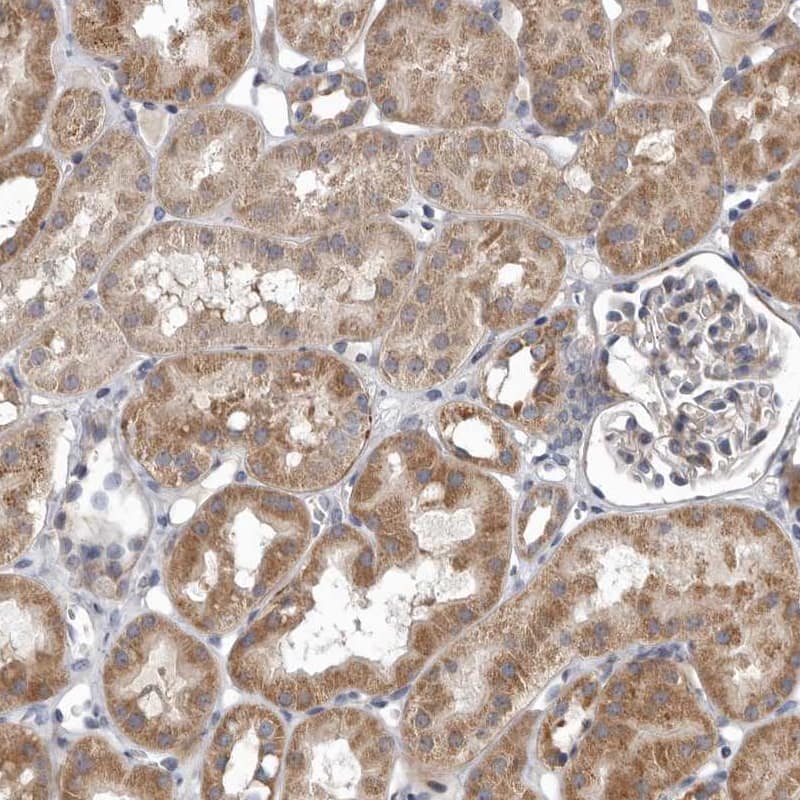 Staining of human kidney shows strong cytoplasmic positivity in cells in tubules.