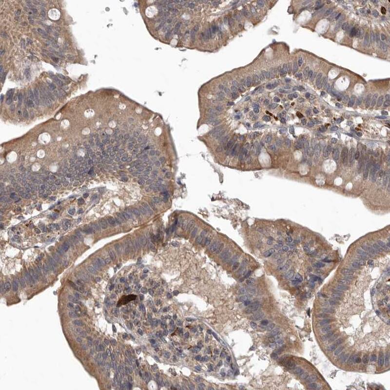 Staining of human small intestine shows strong membranous positivity in glandular cells.