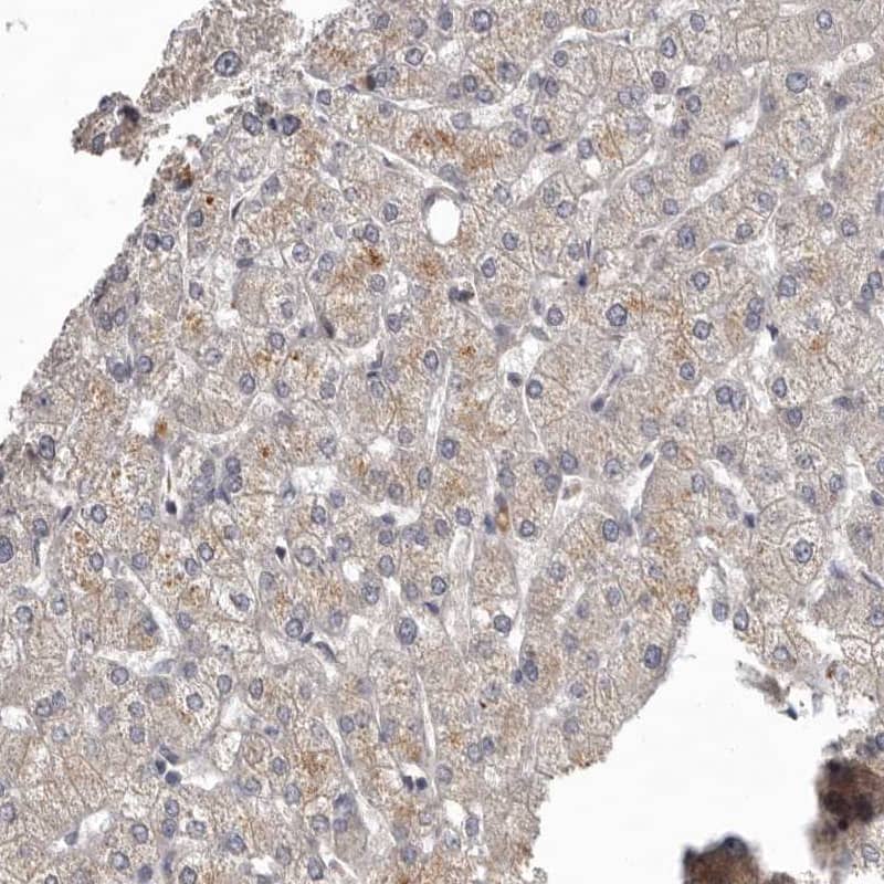 Staining of human liver shows moderate cytoplasmic positivity in hepatocytes.