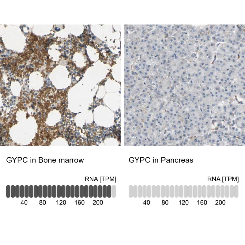 <b>Orthogonal Strategies Validation. </b>Analysis in human bone marrow and pancreas tissues. Corresponding RNA-seq data are presented for the same tissues.