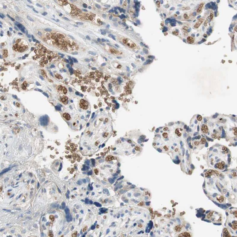 Staining of human placenta shows strong membranous positivity in erythrocytes.