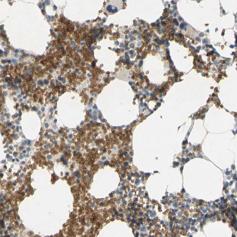 Staining of human bone marrow shows strong membranous positivity in erythrocytes.
