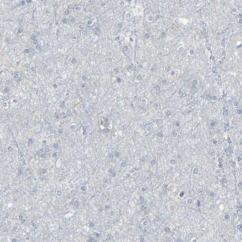 Staining of human cerebral cortex shows no positivity in neurons as expected.