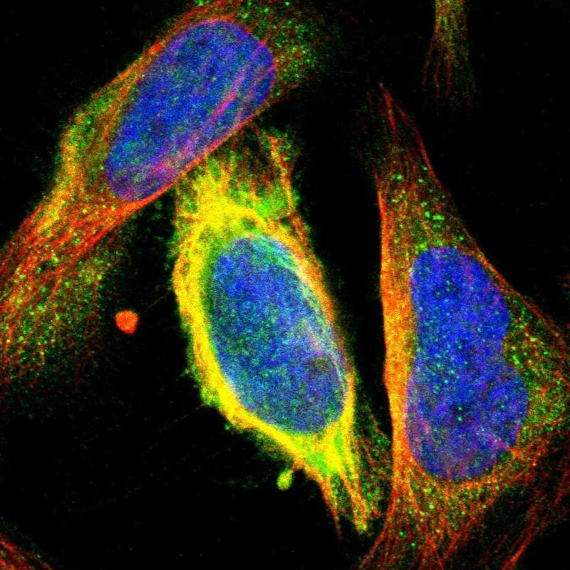 Staining of human cell line U-2 OS shows localization to cytosol & microtubules.