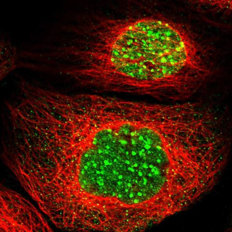 Staining of human cell line A-431 shows localization to nucleoplasm & nuclear bodies.