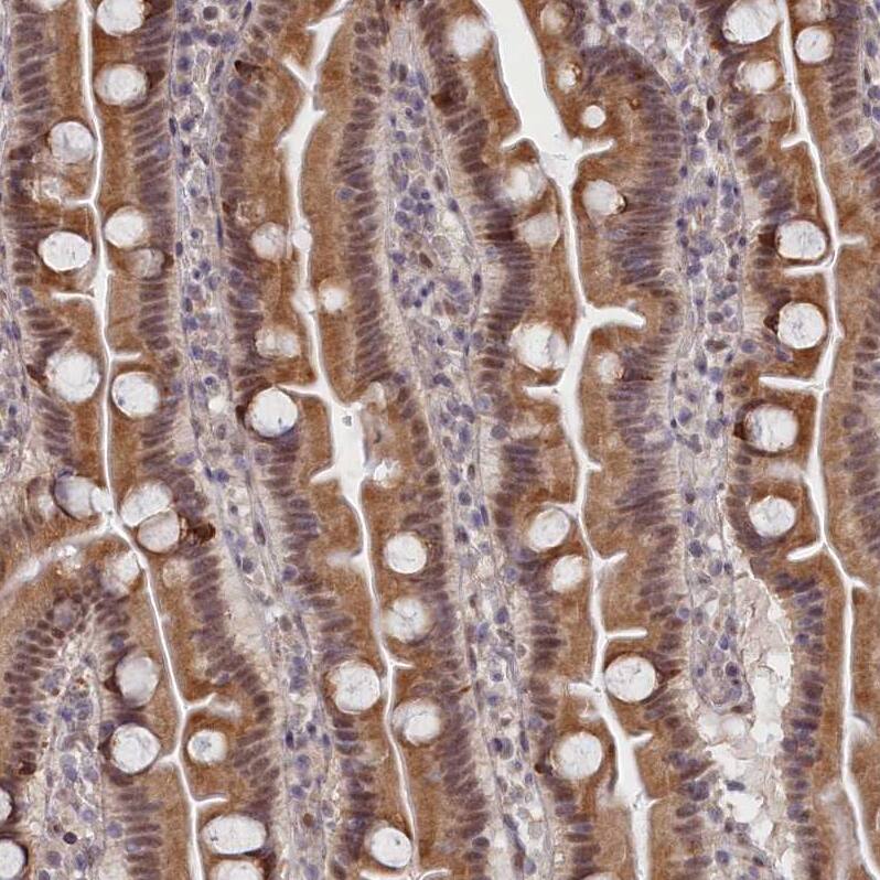 Staining of human small intestine shows moderate nuclear-cytoplasmic positivity in glandular cells.