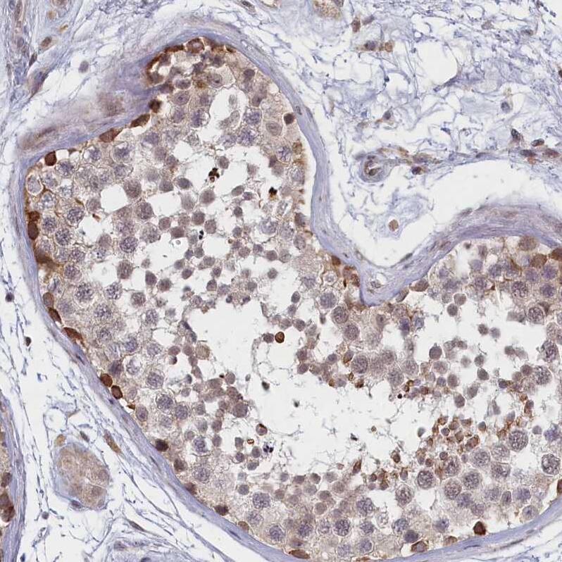 Staining of human testis shows strong nuclear positivity in subset of cells in seminiferous ducts.