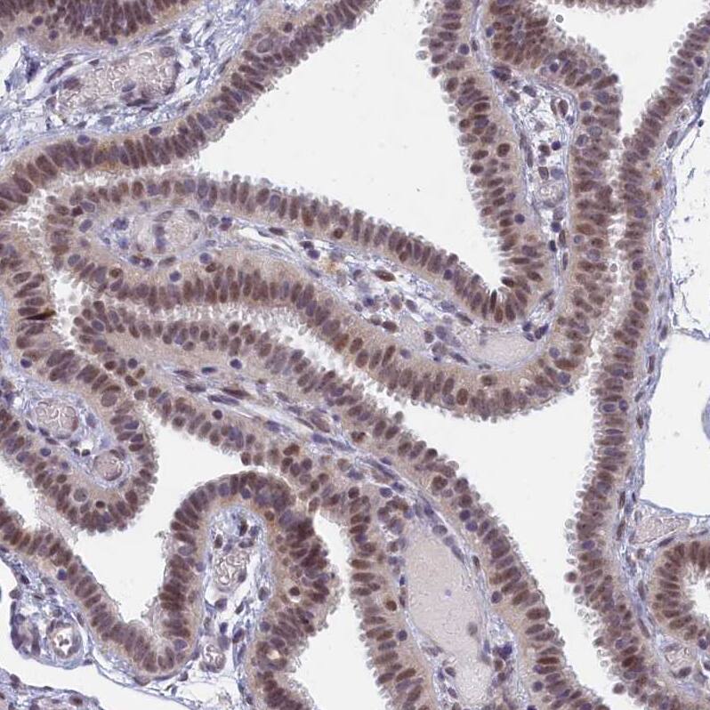 Staining of human fallopian tube shows moderate nuclear positivity in glandular cells with weak cytoplasmic positivity.