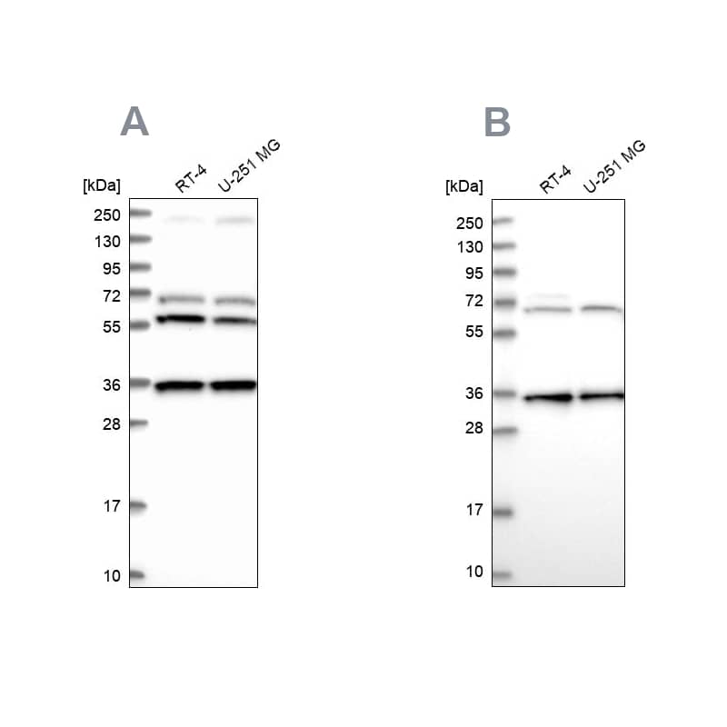 <b>Independent Antibodies Validation. </b>Analysis using Anti-DNAJC17 antibody HPA040914 (A) shows similar pattern to independent antibody HPA041187 (B).