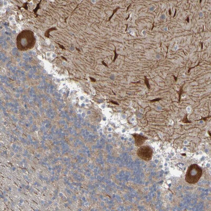 Staining of human cerebellum shows strong cytoplasmic positivity in Purkinje cells.