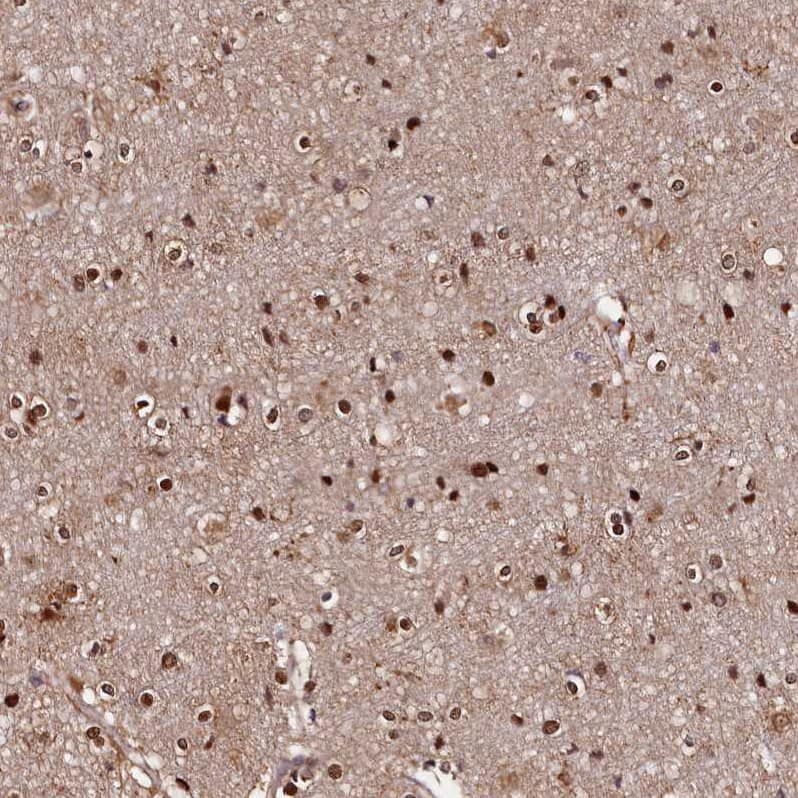 Immunohistochemistry-Paraffin GNL3L Antibody - BSA Free