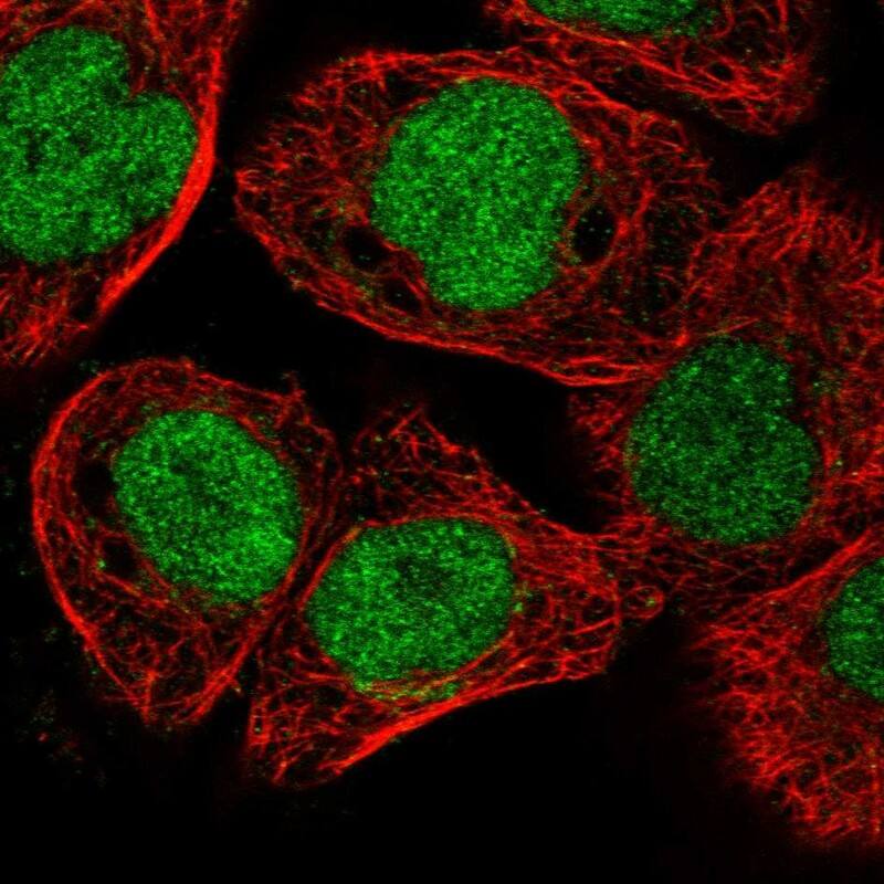 Staining of human cell line A-431 shows localization to nucleoplasm.