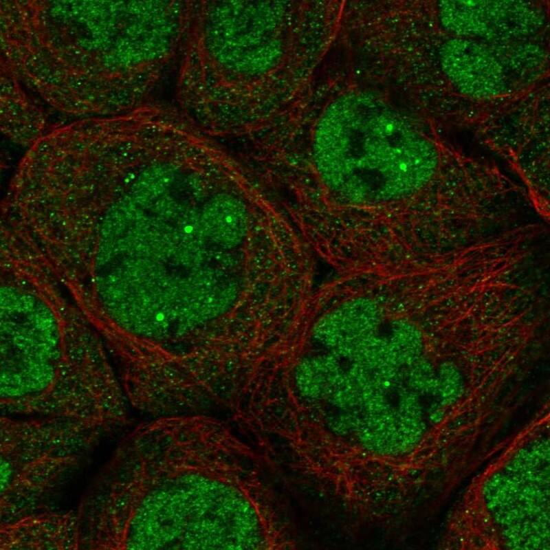 Immunocytochemistry/ Immunofluorescence DALRD3 Antibody - BSA Free