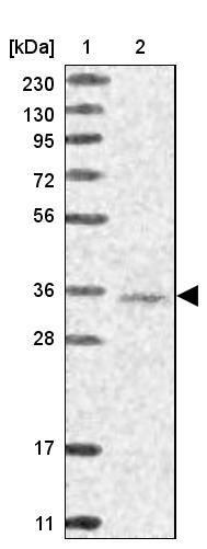 Lane 1: Marker [kDa] 230, 130, 95, 72, 56, 36, 28, 17, 11Lane 2: Human cell line RT-4