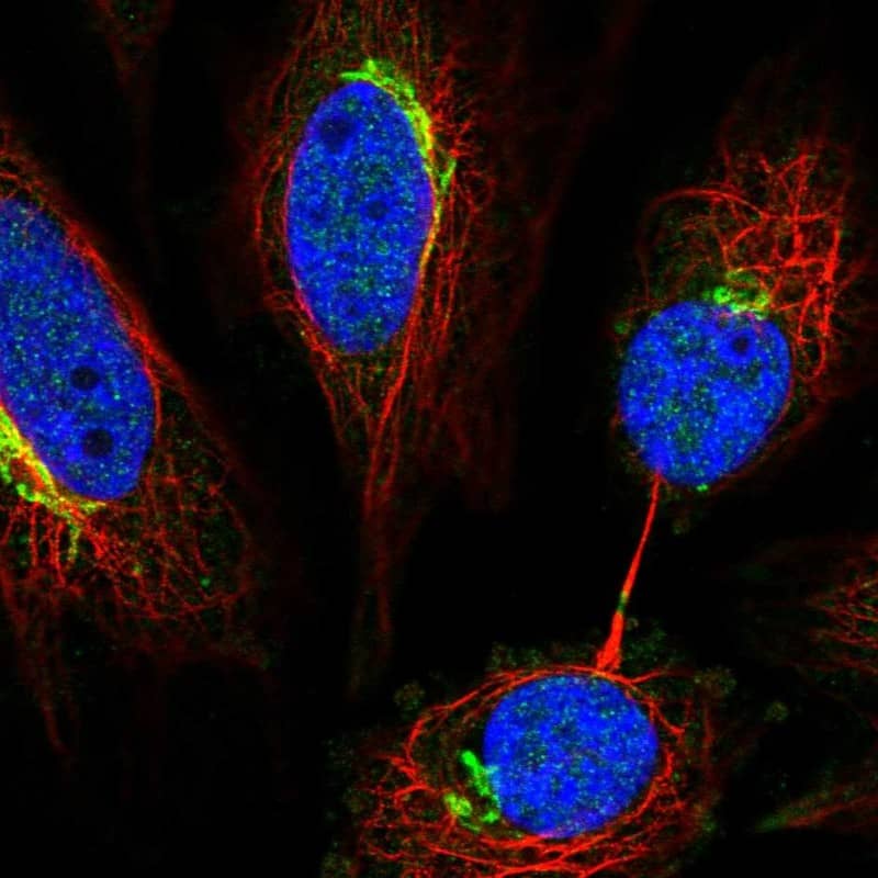 Staining of human cell line SiHa shows localization to the Golgi apparatus.