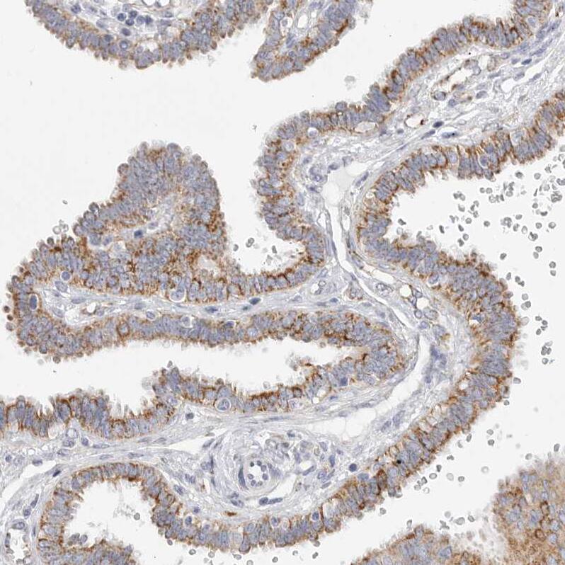 Staining of human fallopian tube shows moderate cytoplasmic positivity in glandular cells.