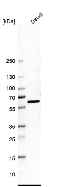 Western Blot Elp3 Antibody - BSA Free