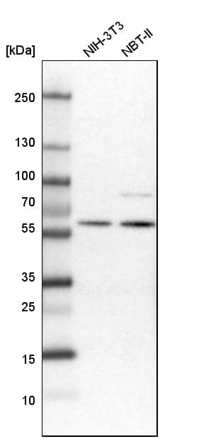 Western Blot Elp3 Antibody - BSA Free