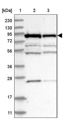 Lane 1: Marker [kDa] 230, 130, 95, 72, 56, 36, 28, 17, 11Lane 2: Human cell line RT-4Lane 3: Human cell line U-251MG sp