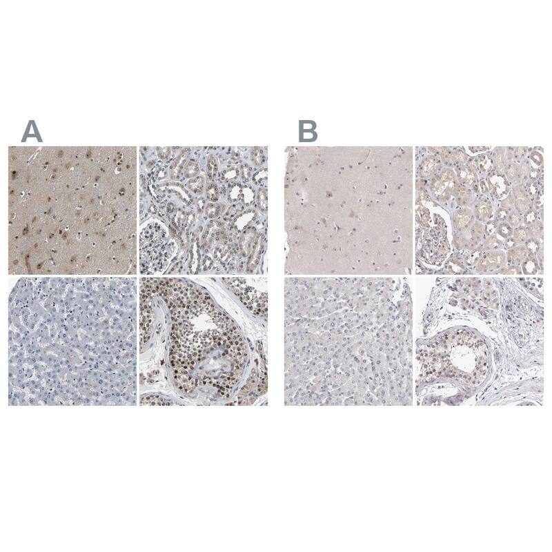 Immunohistochemistry-Paraffin RBM28 Antibody - BSA Free