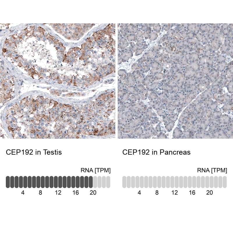 Immunohistochemistry-Paraffin CEP192 Antibody - BSA Free