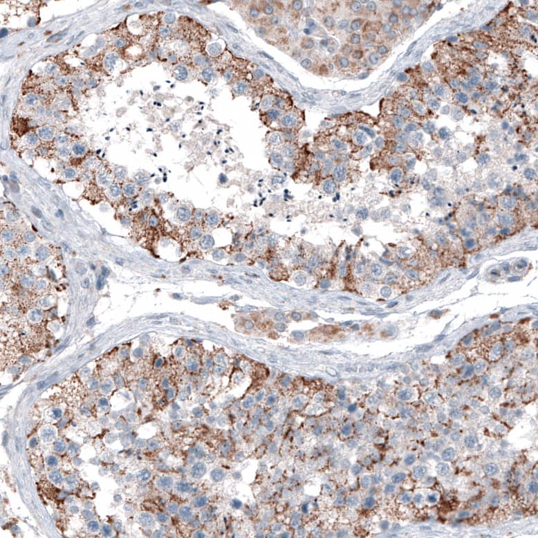 Immunohistochemistry-Paraffin CEP192 Antibody - BSA Free