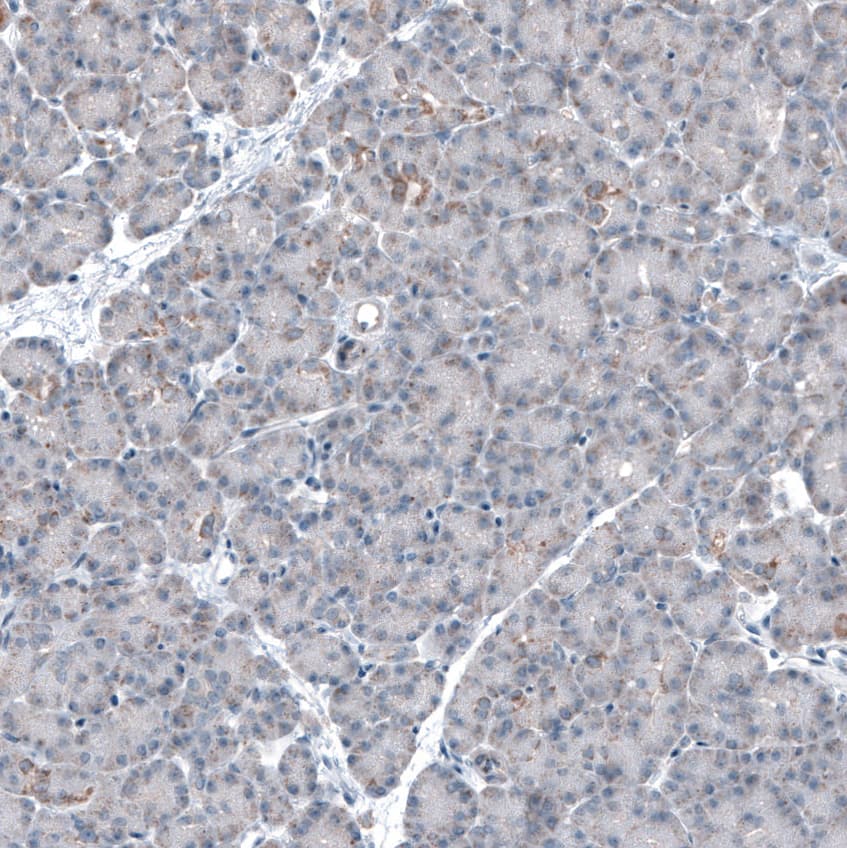 Staining of human pancreas shows few moderate granular cytoplasmic positivity in exocrine glandular cells.