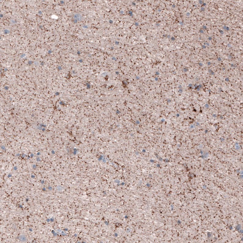 Staining of human cerebral cortex shows moderate granular cytoplasmic positivity.