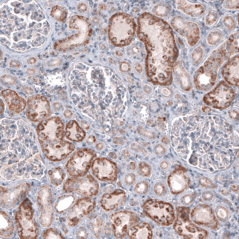 Staining of human kidney shows moderate granular cytoplasmic positivity in cells in tubules.