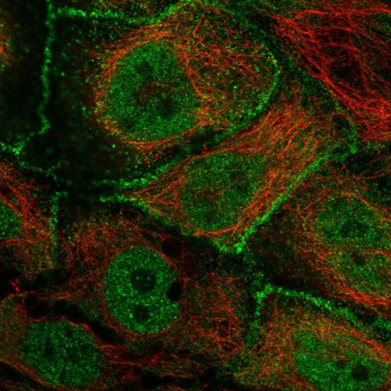Staining of human cell line CACO-2 shows localization to nucleoplasm & cell junctions.