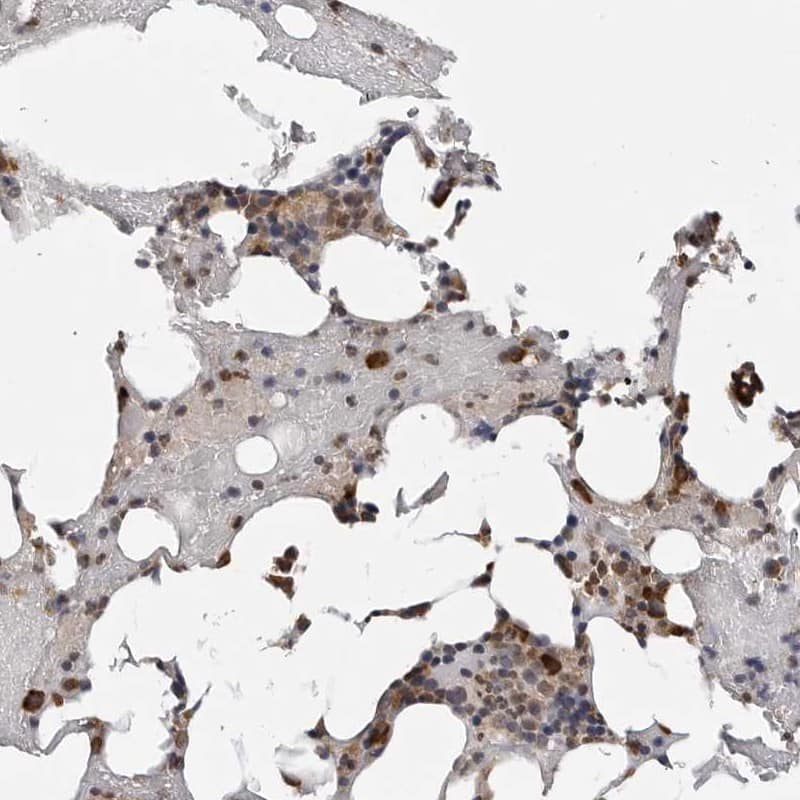 Staining of human bone marrow shows strong cytoplasmic and nuclear positivity in bone marrow poietic cells.