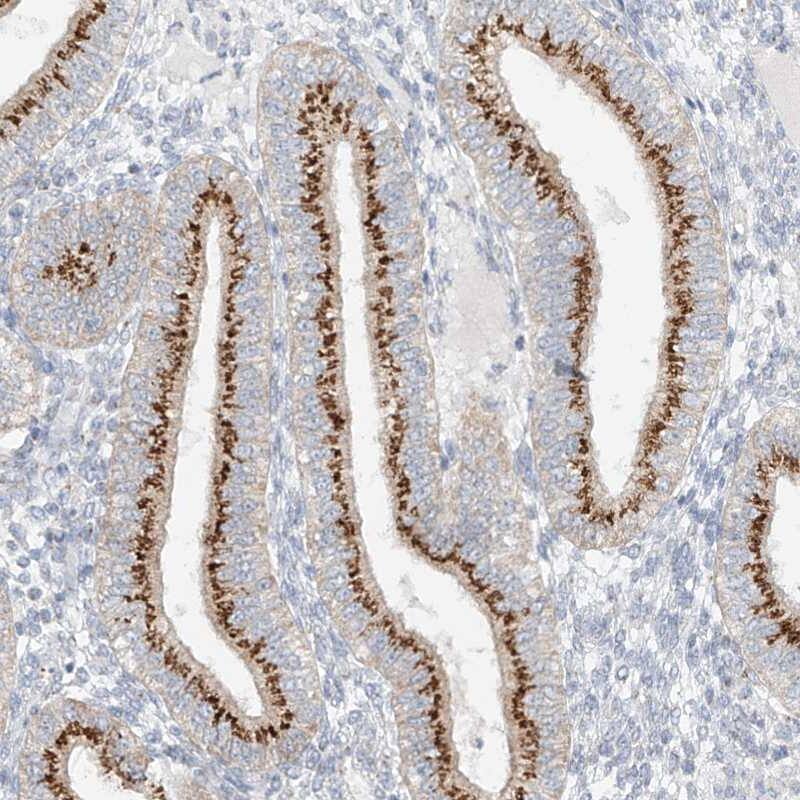 Staining of human corpus, uterine shows strong cytoplasmic positivity with a granular pattern in glandular cells.