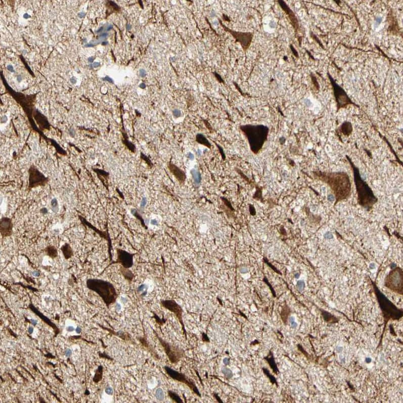 Staining of human cerebral cortex shows strong cytoplasmic positivity in neurons.