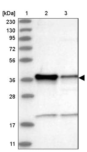 Lane 1: Marker [kDa] 230, 130, 95, 72, 56, 36, 28, 17, 11Lane 2: Human cell line RT-4Lane 3: Human cell line U-251MG sp