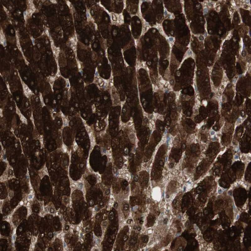 Staining of human liver shows strong cytoplasmic and nuclear positivity in hepatocytes.