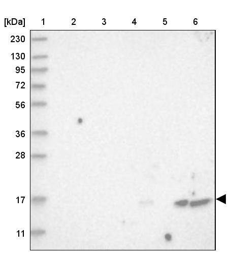 Lane 1: Marker [kDa] 230, 130, 95, 72, 56, 36, 28, 17, 11Lane 2: Human cell line RT-4Lane 3: Human cell line U-251MG spLane 4: Human plasma (IgG/HSA depleted)Lane 5: Human liver tissueLane 6: Human tonsil tissue