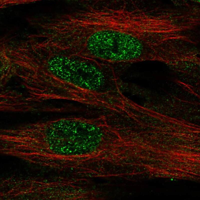 Staining of human cell line BJ shows localization to nucleoplasm.
