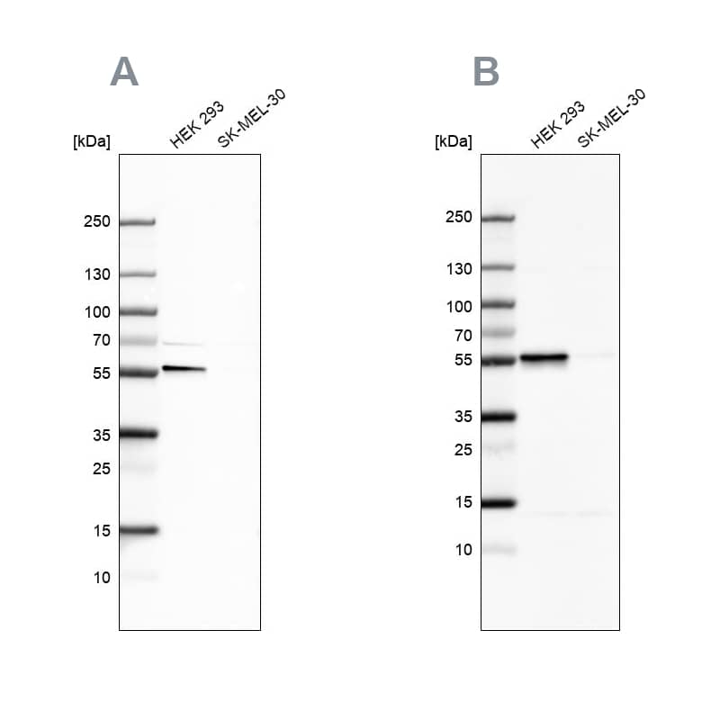<b>Independent Antibodies Validation. </b>Analysis using Anti-FKBP5 antibody HPA031092 (A) shows similar pattern to independent antibody HPA031093 (B).