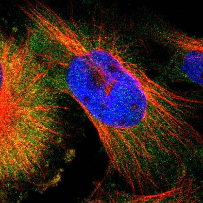 Staining of human cell line U-251 MG shows localization to cytosol.