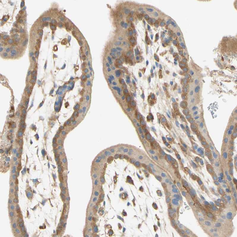 Staining of human placenta shows moderate cytoplasmic positivity in trophoblastic cells.