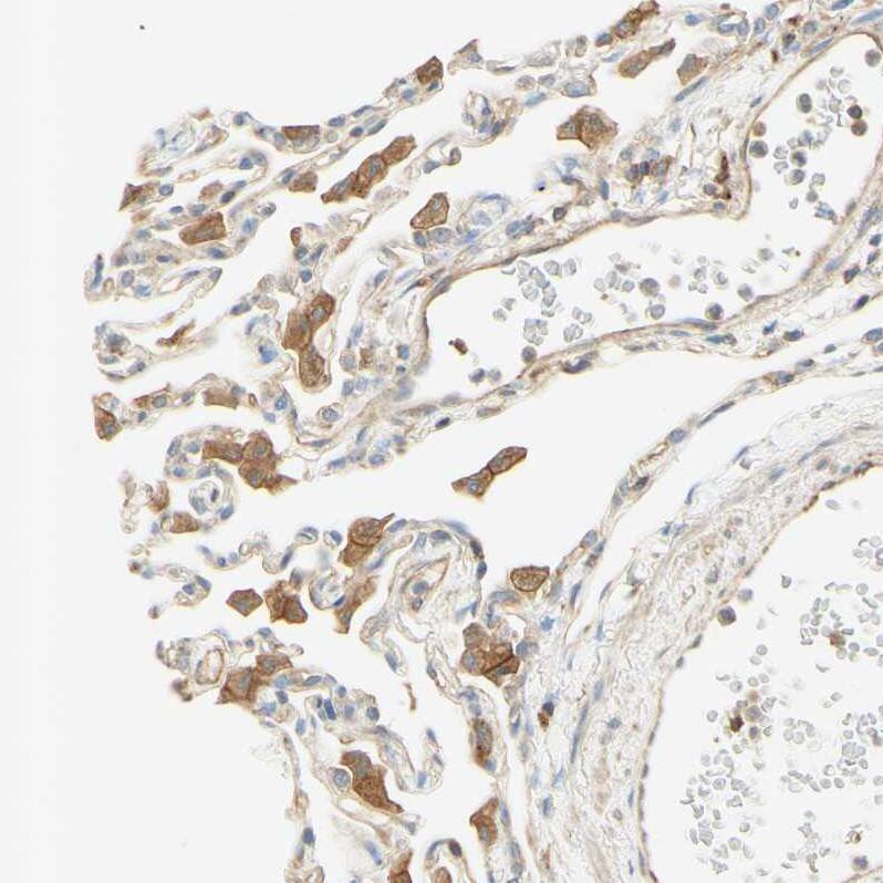 Staining of human lung shows moderate cytoplasmic positivity in macrophages.