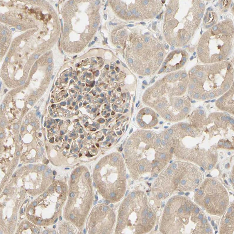 Staining of human kidney shows moderate cytoplasmic positivity in cells in glomeruli.