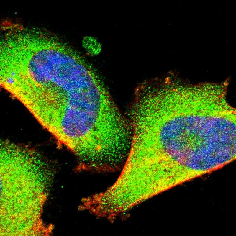 Staining of human cell line U-251 MG shows localization to cytosol.