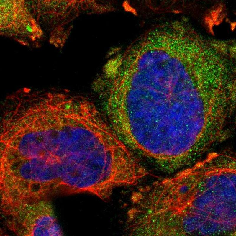 Staining of human cell line A-431 shows localization to cytosol.