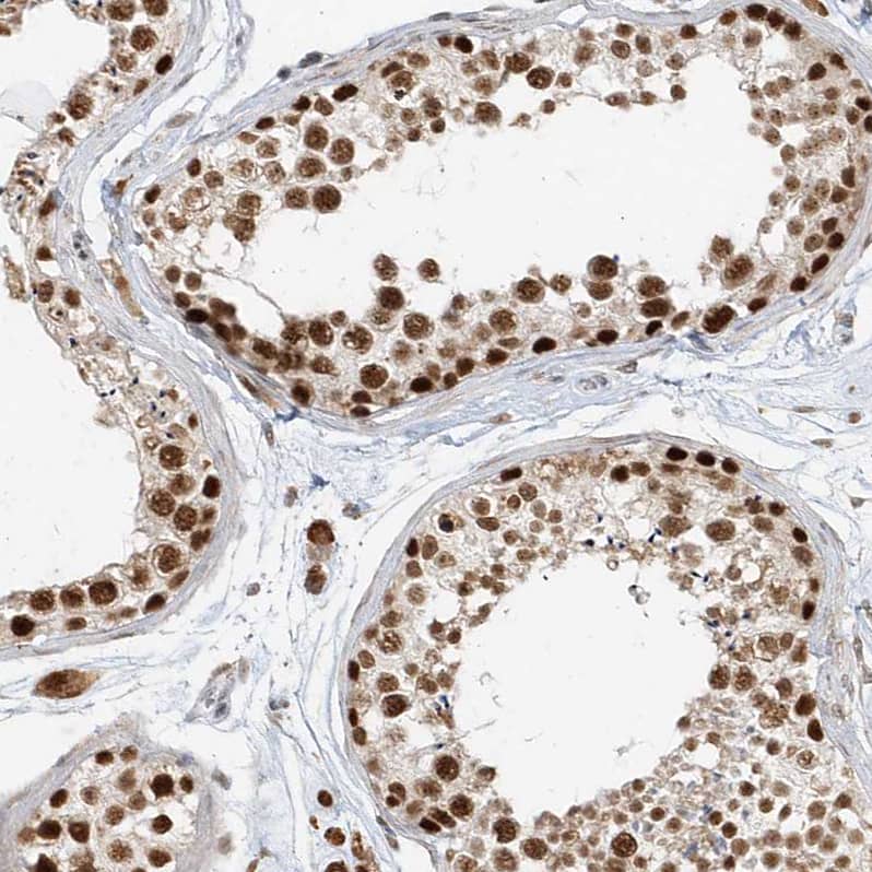 Immunohistochemistry-Paraffin ZNF198 Antibody - BSA Free