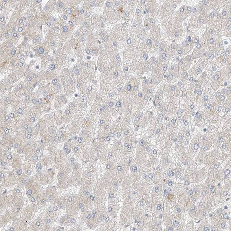 Immunohistochemistry-Paraffin ZNF198 Antibody - BSA Free