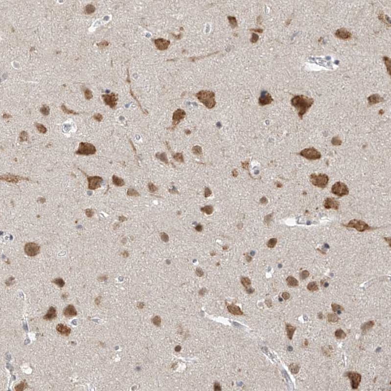 Immunohistochemistry-Paraffin ZNF198 Antibody - BSA Free