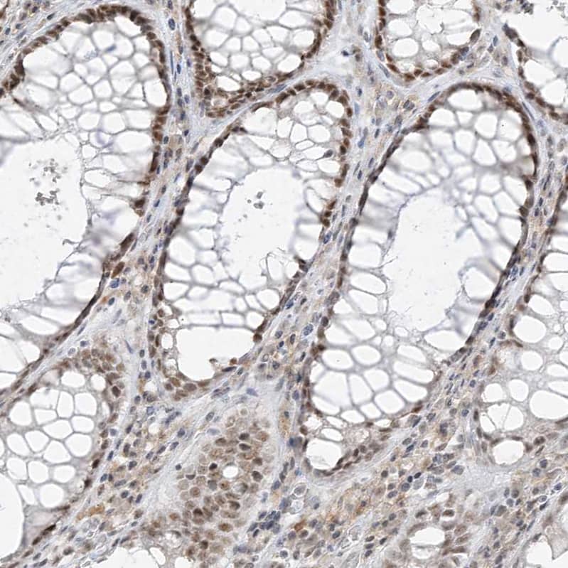 Immunohistochemistry-Paraffin ZNF198 Antibody - BSA Free